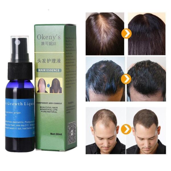 Sunburst Hair Growth Products for women&men anti hair loss products Alopecia Baldness beard oil growth Hair growth spray - Image 6