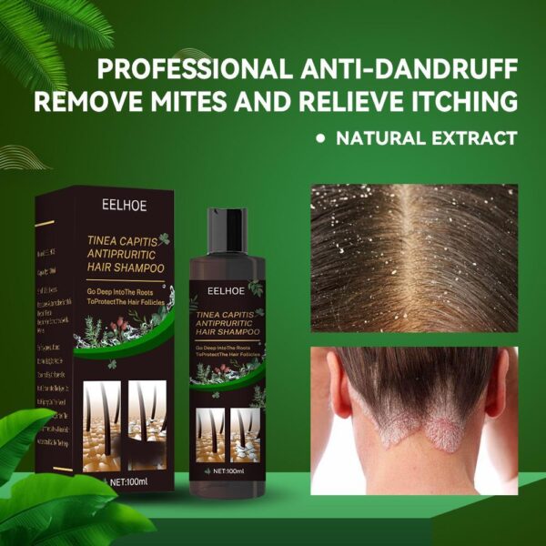 EELHOE Anti-Dandruff Shampoo - Itch Relief, Hair Loss Prevention, Oil Control & Refreshing Care - Image 3