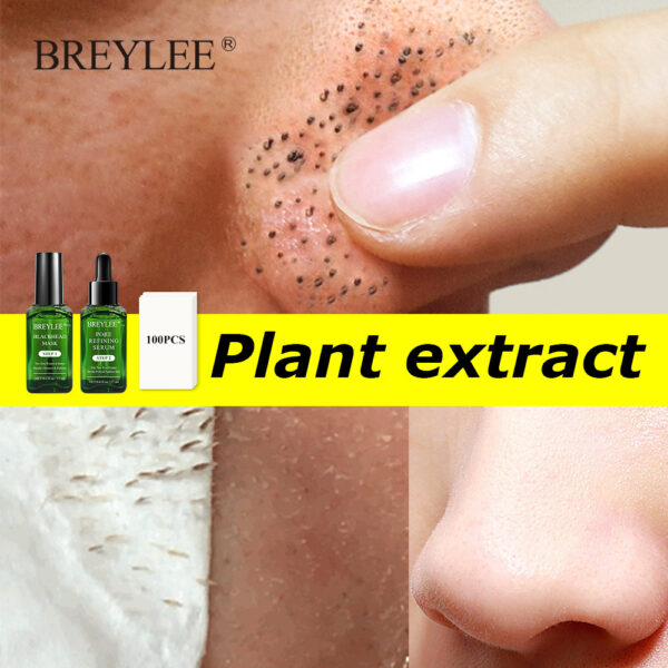 Blackhead Shrinking Combination Kit - Image 5