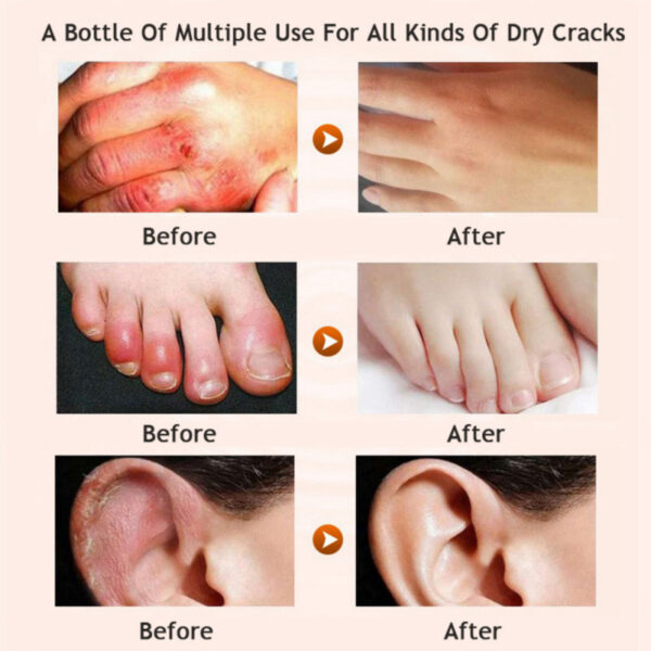 Honey moisturizing cream foot cream leg cream - Image 4