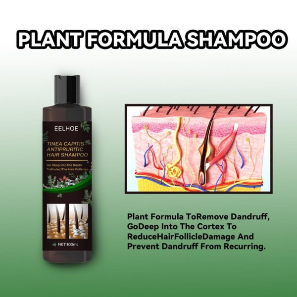 EELHOE Anti-Dandruff Shampoo - Itch Relief, Hair Loss Prevention, Oil Control & Refreshing Care - Image 5