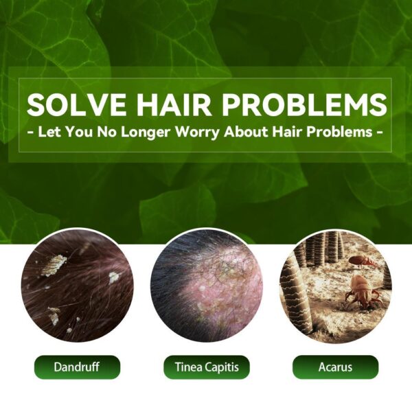 EELHOE Anti-Dandruff Shampoo - Itch Relief, Hair Loss Prevention, Oil Control & Refreshing Care - Image 2