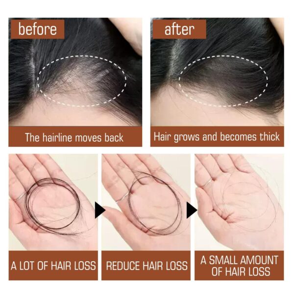 Batana Oil From Honduras - Get Fuller, Thicker, Healthier Hair - Great Gifts For Women  Men Conditioner Haircare Silky - Hair Nutrition - Image 2