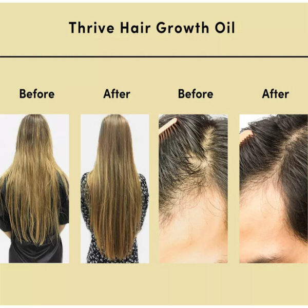 Hair Essential Oil Improve Dryness And Irritability And Nourish - Image 2