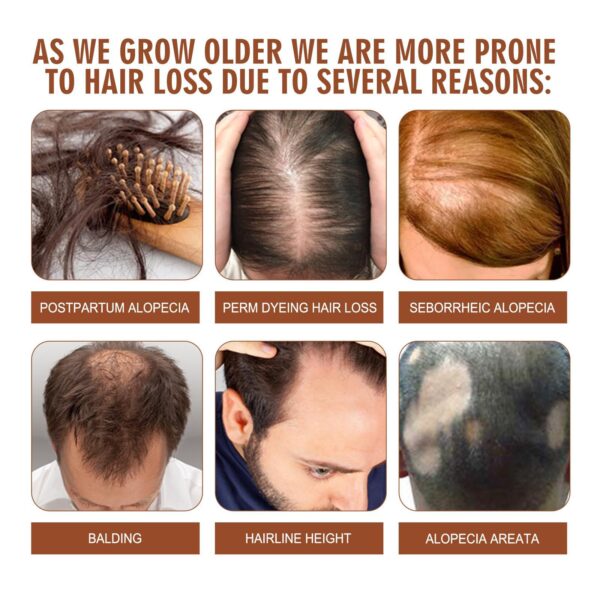 Batana Oil From Honduras - Get Fuller, Thicker, Healthier Hair - Great Gifts For Women  Men Conditioner Haircare Silky - Hair Nutrition - Image 8