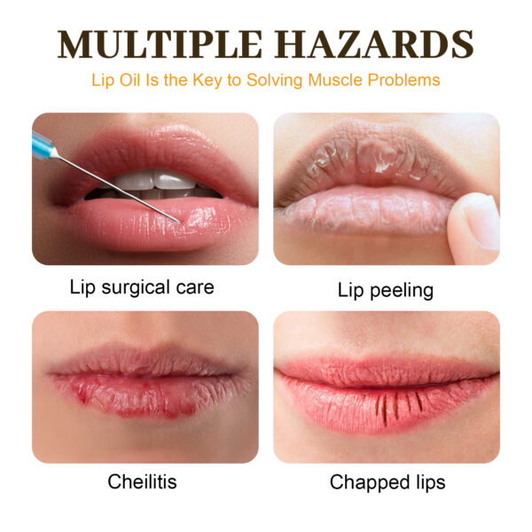 EELHOE Honey Lip Oil, Reduces Lip Lines, Prevents Cracking And Peeling, Moisturizing Lip Care Oil. - Image 5