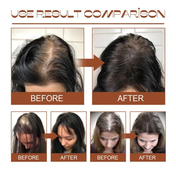Batana Oil From Honduras - Get Fuller, Thicker, Healthier Hair - Great Gifts For Women  Men Conditioner Haircare Silky - Hair Nutrition - Image 3