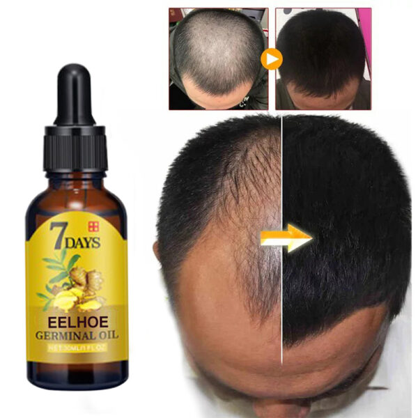 EELHOE Ginger Hair Treatment 20ml Hair Nourishing Hair Care Moisturizing Hair Care Hair Fixing And Anti-Shedding Nutrient Solution - Image 2